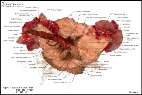 Shawn Bailey and Jennifer Willet - BIOTEKNICA: Teratoma, Anatomy Digitally Generated Duratrans, 2004